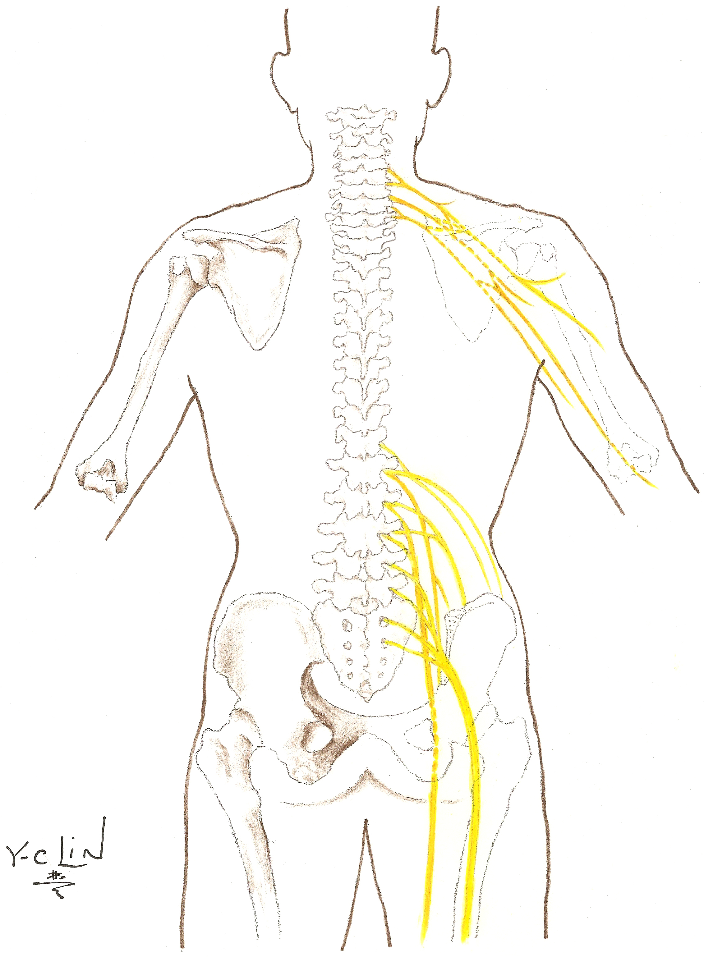 conditions-and-treatments-brachial-plexus-program-michigan-medicine